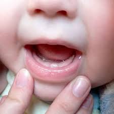 Bebekler Nezaman Diş Çıkartır, Belirtileri