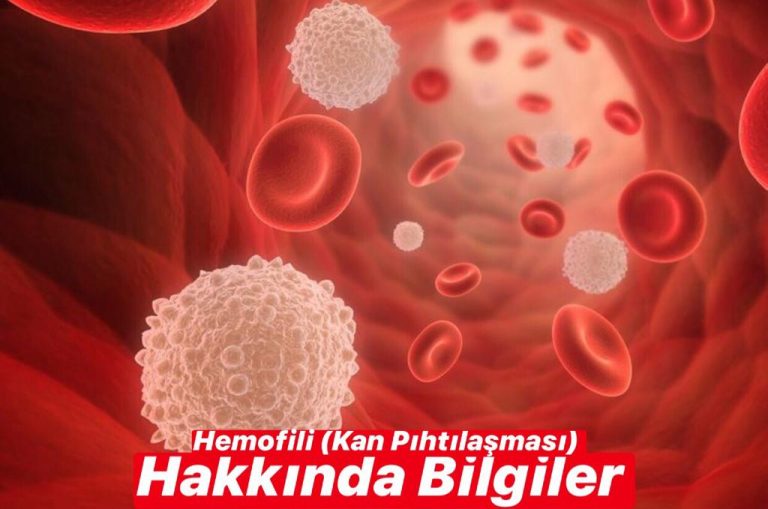 Hemofili (Kanın Pıhtılaşması) Hakkında Bilgiler